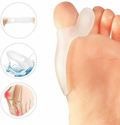 Close-up of adjustable strap on bunion corrector splint
