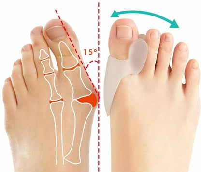 Side view of adjustable toe straightener for bunion support