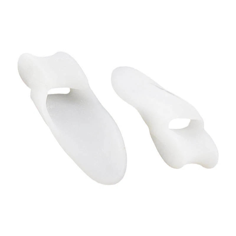 Before and after toe alignment using bunion corrector splint