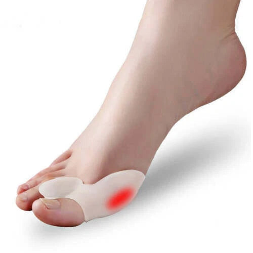 Pair of toe splints included in packaging for both feet
