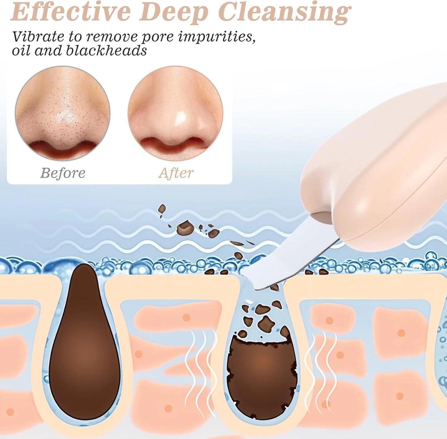 Ultrasonic skin spatula used for deep pore cleaning and blackhead removal