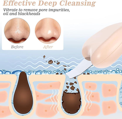 Ultrasonic skin spatula used for deep pore cleaning and blackhead removal